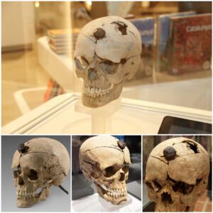 "Unlocking History's Mystery: The Iron-Nailed Skull of a Young Ancient Warrior Revealed"