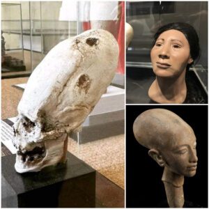 The Mystery of Peru’s Elongated Skulls – Science vs Myth — Louis Wolf