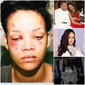 Rihanna: From childhood and first love filled with violence to the richest female singer in the world!