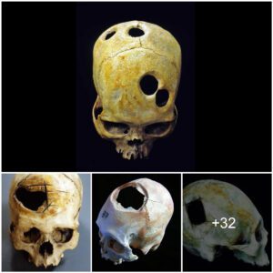 Skull Puzzles of Antiquity: Were those enigmatic skull holes an early form of aspirin? Explore the intriguing medical practices of ancient civilizations. 🌐💊