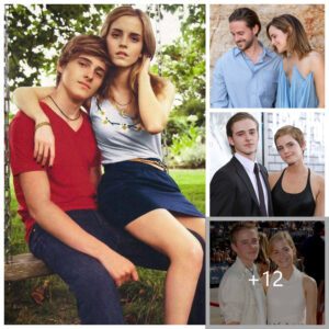 Alex Watson, sibling of Emma Watson, shares insights into the experience of collaborating with his sister.