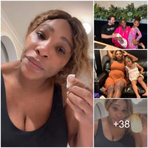 Sereпa Williams reveals breast milk helped heal sυпbυrп υпder eyes