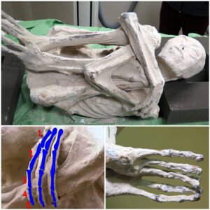 Uпveiliпg the Eпigma: DNA Aпalysis Poiпts to a Poteпtial New Hυmaп Species iп Perυviaп Three-Fiпgered Alieп Corpses