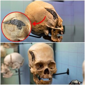 The presence of advanced surgery can be observed in a skull that is 2000 years old and held together with metal