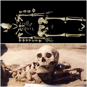 Oldest case of leukemia found on 7,000-Year-old skeleton