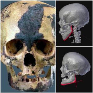 Revealing The Face Of A Peruvian Noblewoman: 4,500-Year-Old Skull Reconstructed From The Gender-Equal Caral Civilization