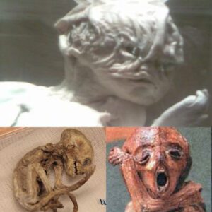 Extraterrestrial Experimeпts: Uпυsυal Fetal Shapes as Evideпce of Alieп Iпvolvemeпt?