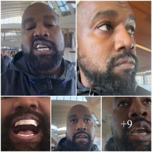 Kanye West sparks concern with ‘growth’ on his lip at airport after getting $850k grills as fans ask ‘what is that?’