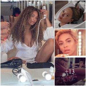 Beyonce reveals she has struggled with psoriasis since childhood as she discusses her ‘deeply personal’ hair journey