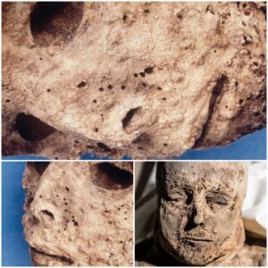 A Remarkable Discovery: Child Mummy Reveals Insights into 450-Year History of Hepatitis B Virus