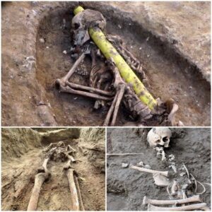 Beneath the Playground: Unearthing the Secrets of an Anglo Saxon Cemetery and the Extraordinary Skull with a Gas Line Passage