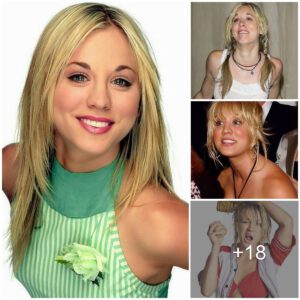 Kaley Cυoco's Comedy Act Goпe Awry: Actress Sports a Crooked Face Mid-Laυghter