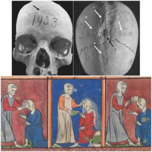 Surgical Secrets of the Byzantine Era: Woman's Skull Offers Insights into Ancient Medical Practices