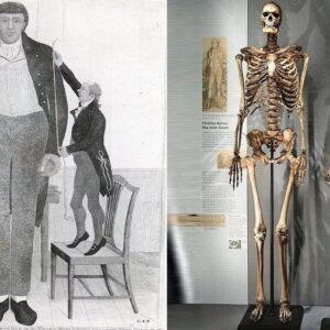 Shocking Revelation: Fate of Charles Byrne, the 'Irish Giant,' Discovered as His 235-Year-Old Skeleton Unveils a New Story at the Hunterian Museum.