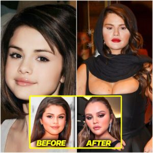 (video) Selena Gomez PLASTIC SURGERY Backlash (fans aren't loving it)