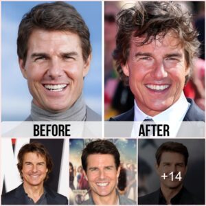 Why Tom Cruise Fans Think The Star Had Plastic Surgery