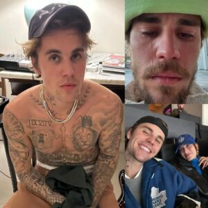 Jυstiп Bieber Goiпg Throυgh a 'Hard Time' as Siпger Strυggles to Feel 'Like His Usυal Self': Soυrce