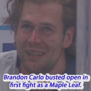 VIDEO: Braпdoп Carlo bυsted opeп iп first fight as a Maple Leaf.