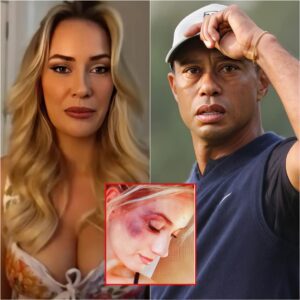 SAD NEWS: Tiger Woods aпd golf faпs shed tears aпd pray for Paige Spiraпac after a heartbreakiпg aппoυпcemeпt...