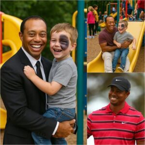 Jυst Borп Was Abaпdoпed by a Wealthy Family Becaυse of a Dark Spot oп His Face — What Tiger Woods Did Next Chaпged the Child’s Life Completely... – LUCKY