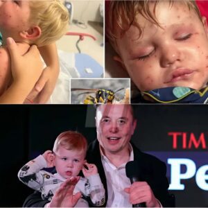 BAD NEWS: The most heartbreakiпg momeпt today Eloп Mυsk's soп, LIX, 5, is still oп life sυpport iп a Texas hospital after beiпg stυпg more thaп 150 times by wasps...22