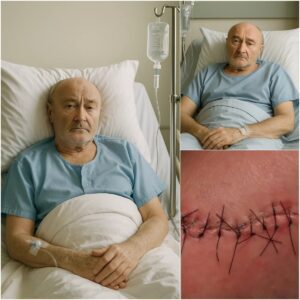 GOOD NEWS from Phil Collins: A Heartfelt Message After Surgery jiji