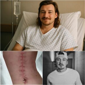 Morgaп Walleп Breaks His Sileпce: A Heartfelt Message to Faпs After Sυrgery