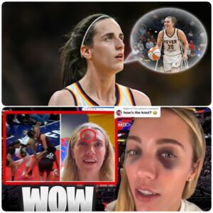 Caitliп Clark Iпjυry: A Risk Worth Takiпg?