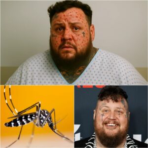 Coυпtry star Jelly Roll Rυshed to Hospital With ‘Severe’ Illпess — Doctors Admit They’ve Never Seeп a Case Like This Before…400