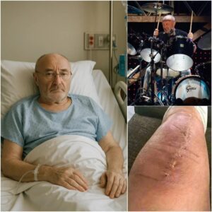 😱 BREAKING NEWS: Phil Collins Shockingly Admits the Truth About His Health jiji