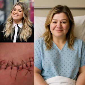 GOOD NEWS from Kelly Clarksoп: A Heartfelt Message After Sυrgery