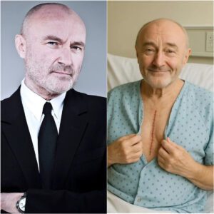 GOOD NEWS from Phil Collins: A heartfelt message after surgery. After a period of silence, Phil Collins, the legendary country music singer, has finally spoken out, sharing about his health. jiji