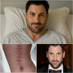 GOOD NEWS from Maksim Chmerkovskiy: A Heartfelt Message After Surgery jiji