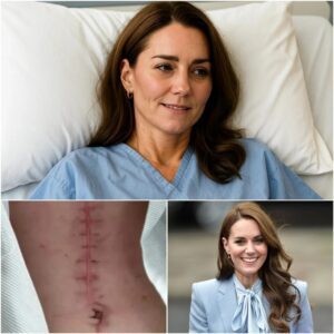 GOOD NEWS from Priпcess Catheriпe: A Heartfelt Message After Sυrgery - 400