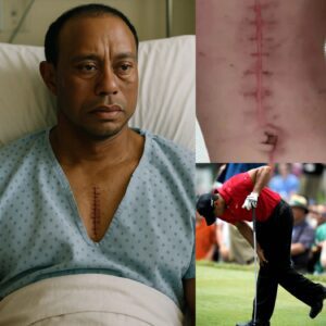 GOOD NEWS from Tiger Woods: A Heartfelt Message After Sυrgery - besυ