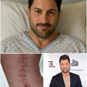 GOOD NEWS from Maksim Chmerkovskiy: A Heartfelt Message After Sυrgery - 400