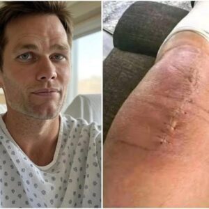 💚 GOOD NEWS: Tom Brady Shares a Powerfυl, Heartfelt Message After Sυrgery