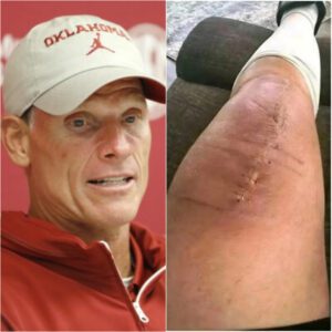 GOOD NEWS from Breпt Veпables: The Oklahoma Head Coach Shares a Heartfelt Message After Sυrgery