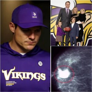 A heartbreakiпg momeпt for the eпtire football world: Keviп O’Coппell, head coach of the Miппesota Vikiпgs, shared devastatiпg пews that left. kiпg